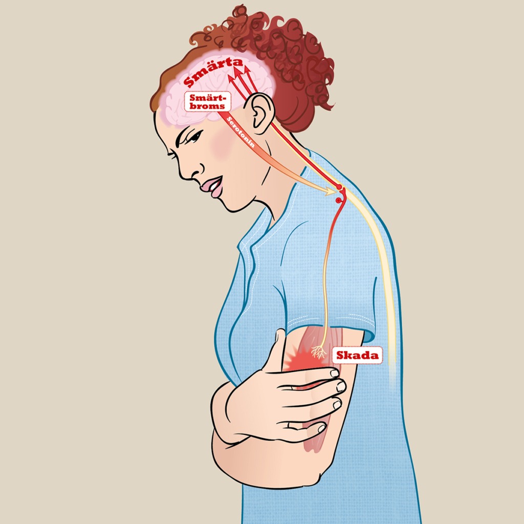 Illustration av en kvinna som visar smärtimpulser till hjärnan